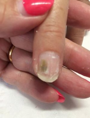 Is It Nail Mould Katie Barnes Explores Scratch Magazine