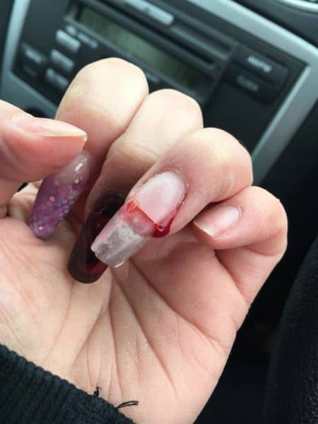 What on Earth is causing my nails to split and break in layers like this?  Help! : r/TheGirlSurvivalGuide