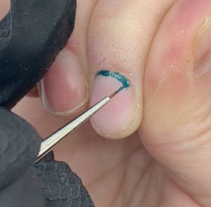 kb cuticle step 5